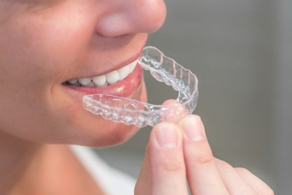 Best Braces and Aligners in Maninagar Ahmedabad - Dev Multi Speciality Dental Care