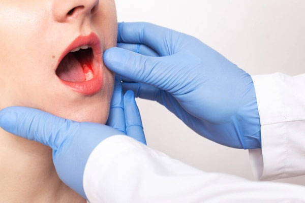 Oral Cancer Dentist in Ahmedabad