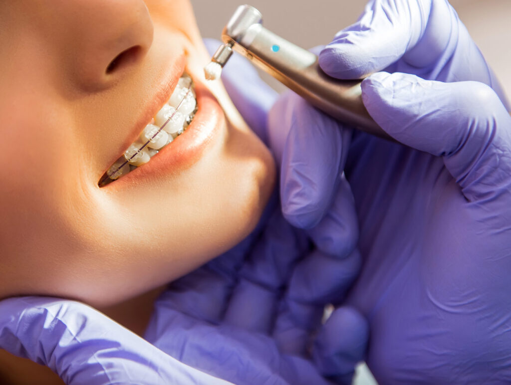 Best Orthodontics Treatment in Ahmedabad