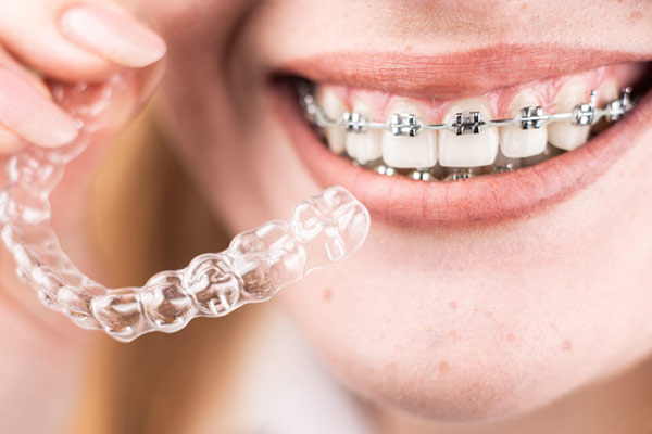 Cosmetic Dentist in Ahmedabad