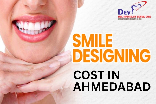Treatments Included in Smile Designing