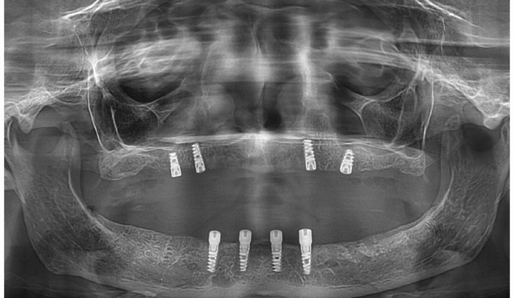 {{brizy_dc_image_alt imageSrc=