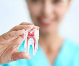 Root Canal Treatment in Ahmedabad