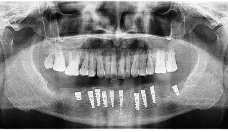 {{brizy_dc_image_alt imageSrc=