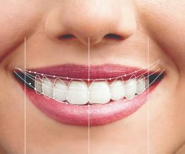 Smile Makeover Clinic in Ahmedabad